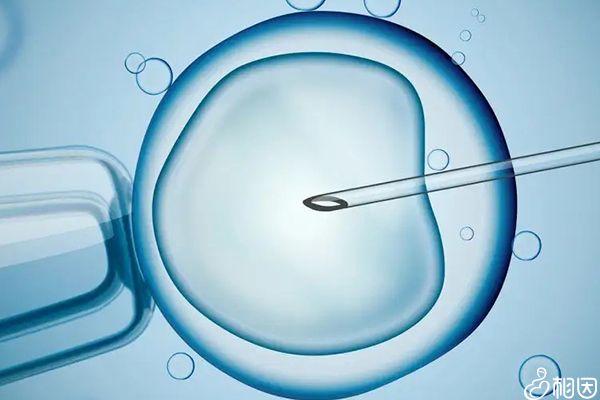 预防精子DNA碎片率高有技巧,弄清引起原因避免不是事!